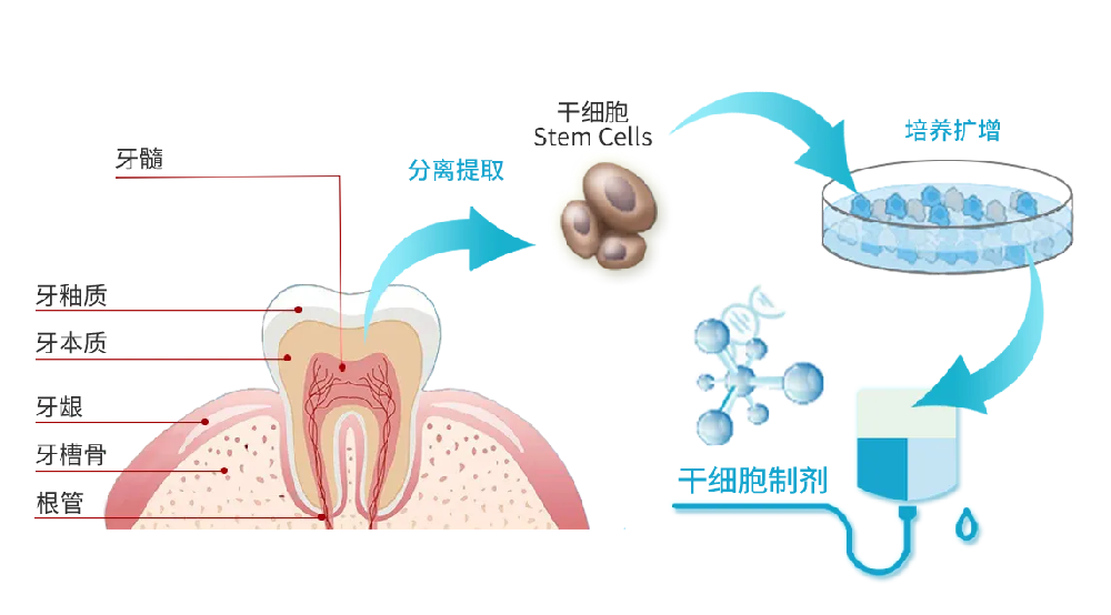 拔掉的牙齒可以用來儲存牙髓干細胞嗎？